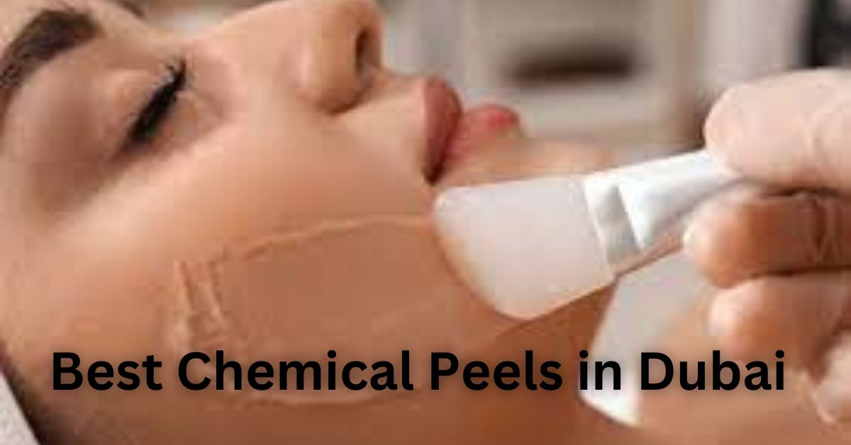 Best Chemical Peels in Dubai