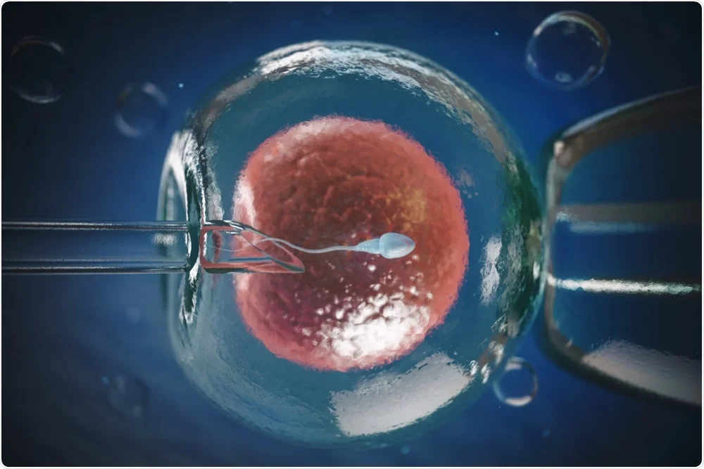 What is IVF